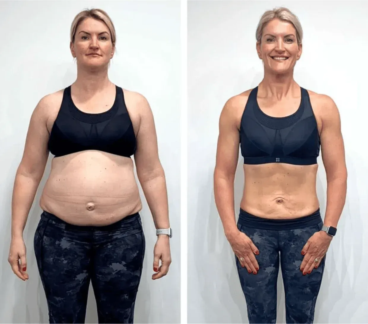 Julia Transformation